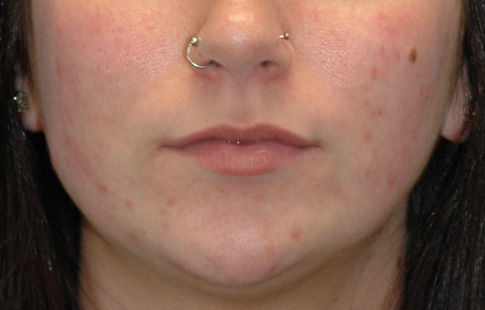 Lips — before (set 3)